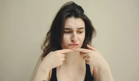 Acheter Isotrétinoïne 20 mg : Une solution efficace contre l’acné sévère